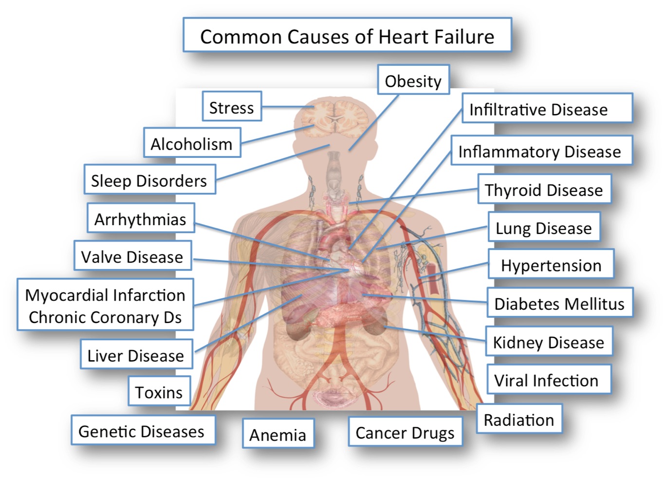 heart-failure-is-caused-by-many-different-heart-problems